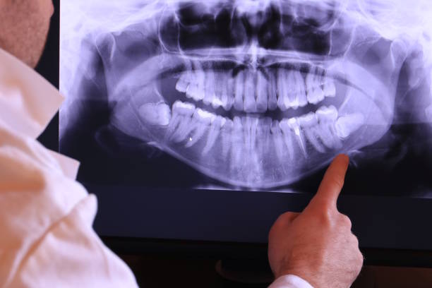 Best Emergency Treatment for Dental Infections or Abscesses in Haltom City, TX